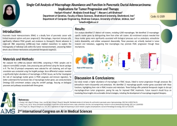 Single-Cell Analysis of Macrophage Abundance and Function in Pancreatic Ductal Adenocarcinoma: Implications for Tumor Progression and Therapy