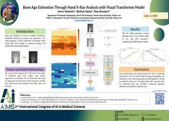 Bone Age Estimation Through Hand X-Ray Analysis With Visual Transformer Model